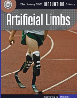 Artificial_Limbs